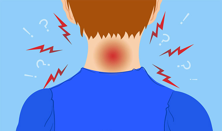 đau mỏi vai gáy thường xuyên