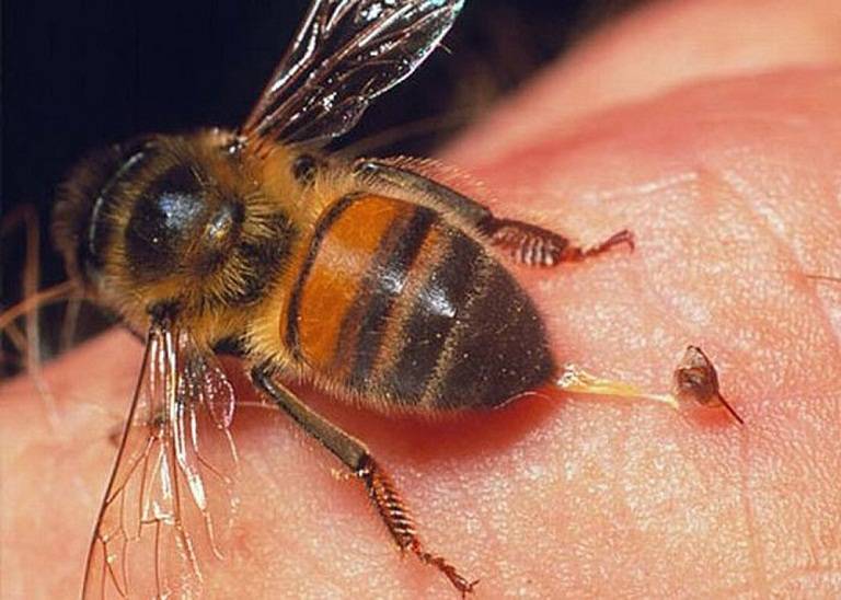 Chữa viêm khớp dạng thấp bằng nọc ong