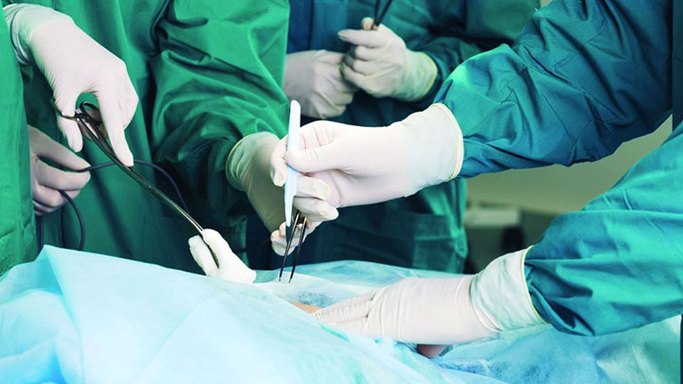 Phẫu thuật trĩ khâu kín thường gây biến chứng áp xe vết mổ 